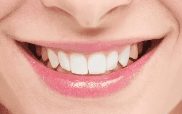 Attractive Smile